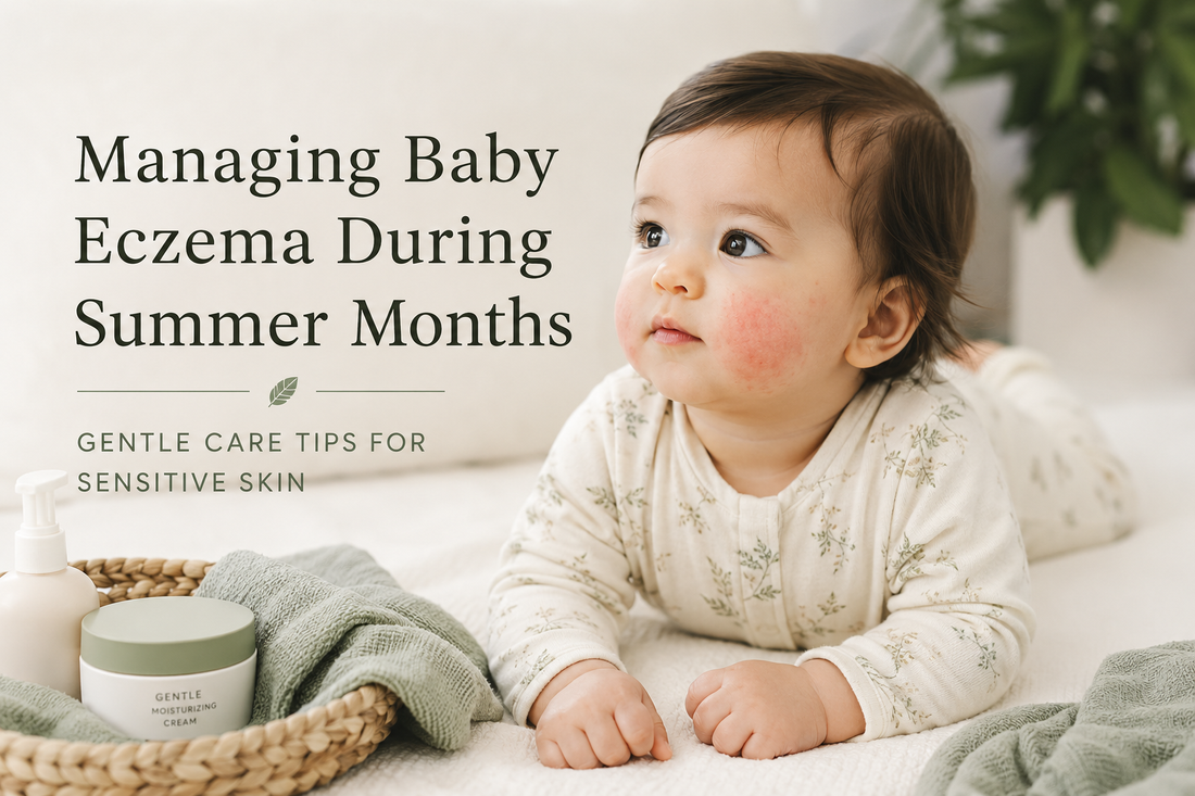 Managing Baby Eczema During Summer Months:&nbsp;